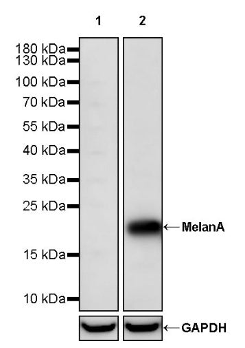 MelanA Recombinant Rabbit mAb (SDT-3352)
