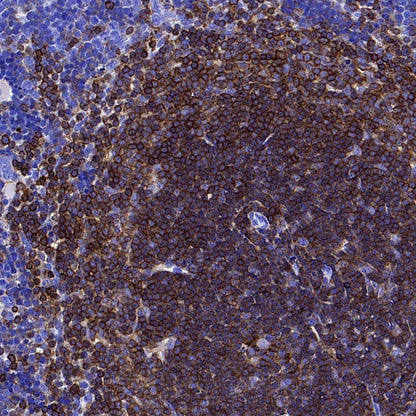 CD45 Recombinant Rabbit mAb (S-3361)