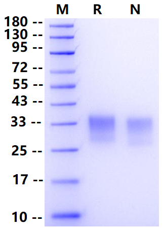FITC-Labeled CD7 His Tag Protein, Human