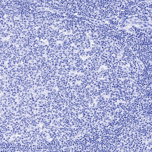 S-RMab® Desmin Recombinant Rabbit mAb (SDT-109-114)