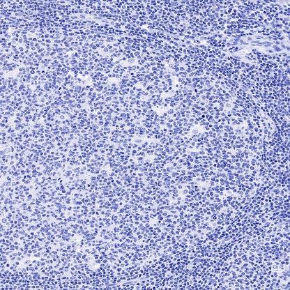 S-RMab® Desmin Recombinant Rabbit mAb (SDT-109-114)