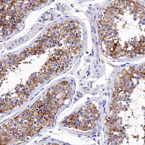 S-RMab® MCT4 Recombinant Rabbit mAb (S-1437-7)