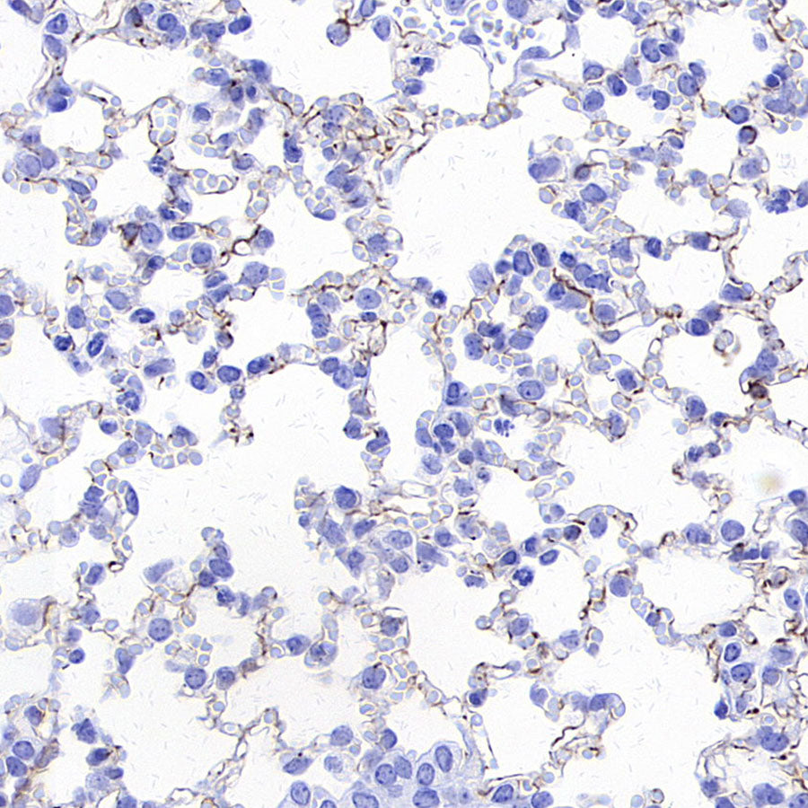 Nestin Recombinant Rabbit mAb (S-3890-61)