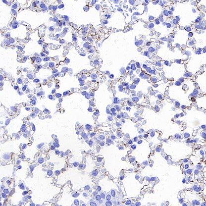 Nestin Recombinant Rabbit mAb (S-3890-61)