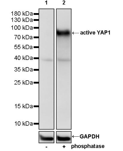 active YAP1 Recombinant Rabbit mAb (S-3261)