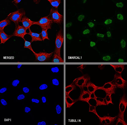 SMARCAL1 Recombinant Rabbit mAb (S-2110-328)