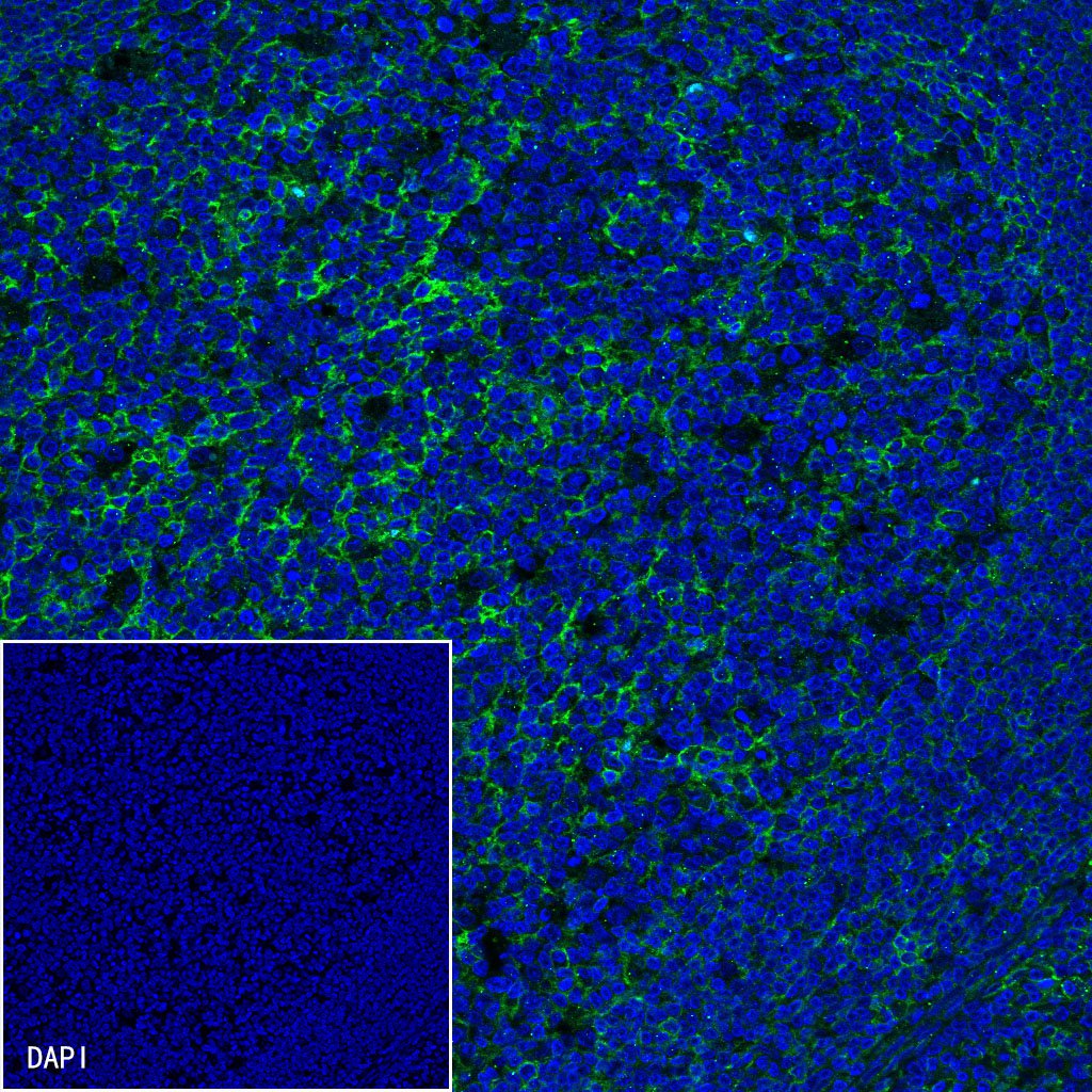 CD99 Recombinant Rabbit mAb (SDT-R122)