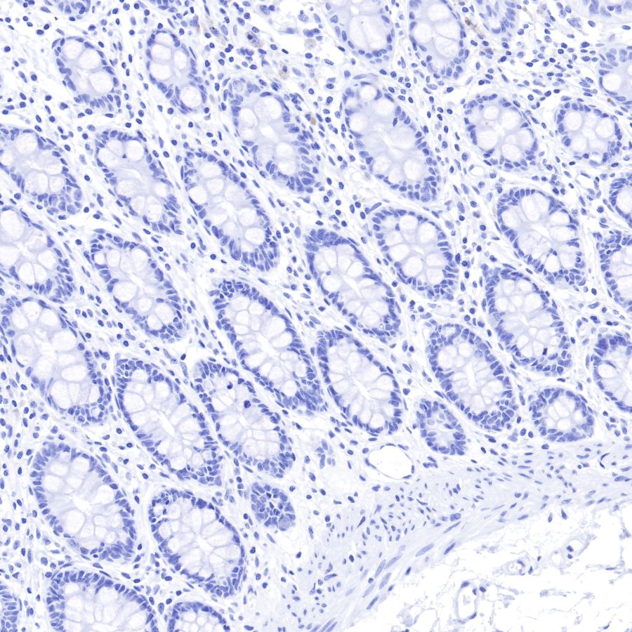 Insulin Recombinant Rabbit mAb (SDT-026-17)