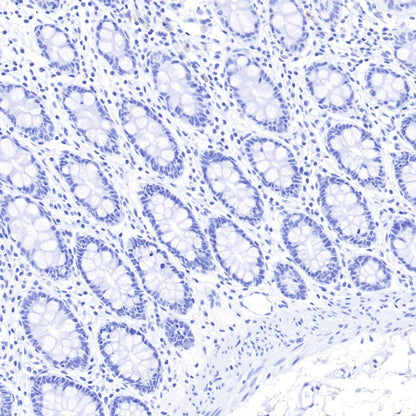 Insulin Recombinant Rabbit mAb (SDT-026-17)