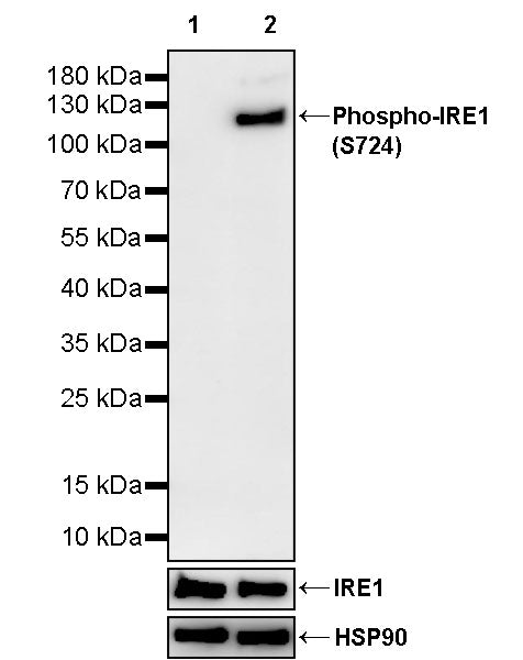 Phospho-IRE1 (S724) Recombinant Rabbit mAb (S-3480-15)