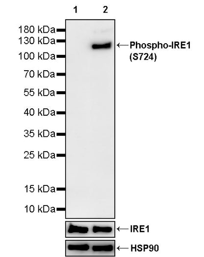 Phospho-IRE1 (S724) Recombinant Rabbit mAb (S-3480-15)