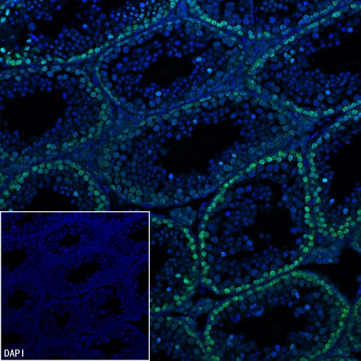 Cyclin E1 Recombinant Rabbit mAb (SDT-2512-182)