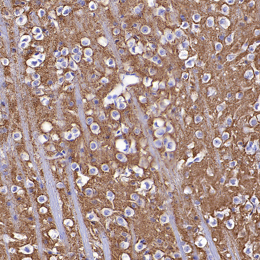 SV2A Recombinant Rabbit mAb (S-3732-3)