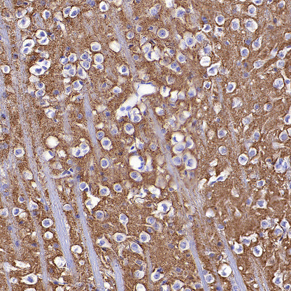 SV2A Recombinant Rabbit mAb (S-3732-3)