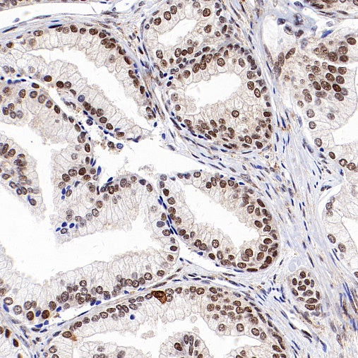 PGC1 beta Recombinant Rabbit mAb (S-1212-146)