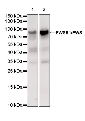 EWSR1/EWS Recombinant Rat mAb (S-R201)