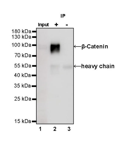 β-Catenin Recombinant Rabbit mAb,PBS Only (SDT-336-23)
