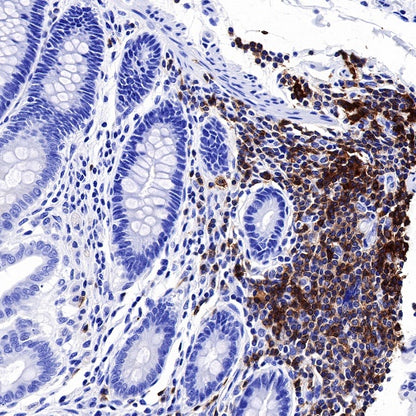 CCR7 Recombinant Rabbit mAb (S-999-29)