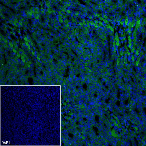 IRP2 Recombinant Rabbit mAb (S-4592-56)