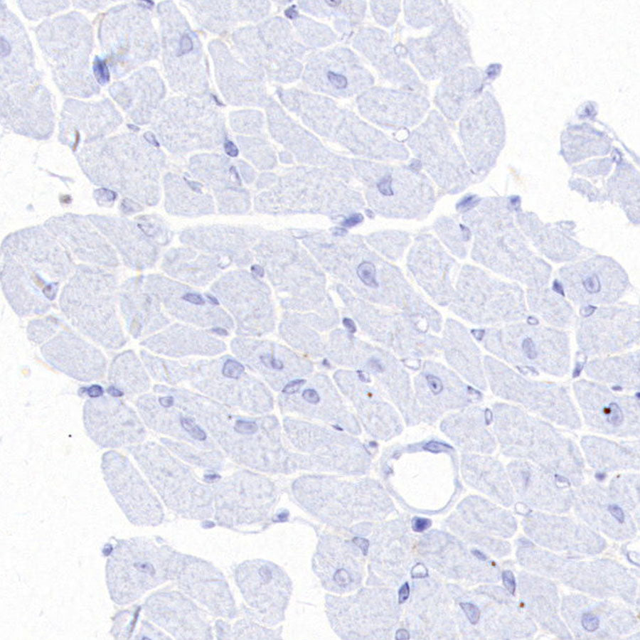 YTHDC2 Recombinant Rabbit mAb (S-3338-41)