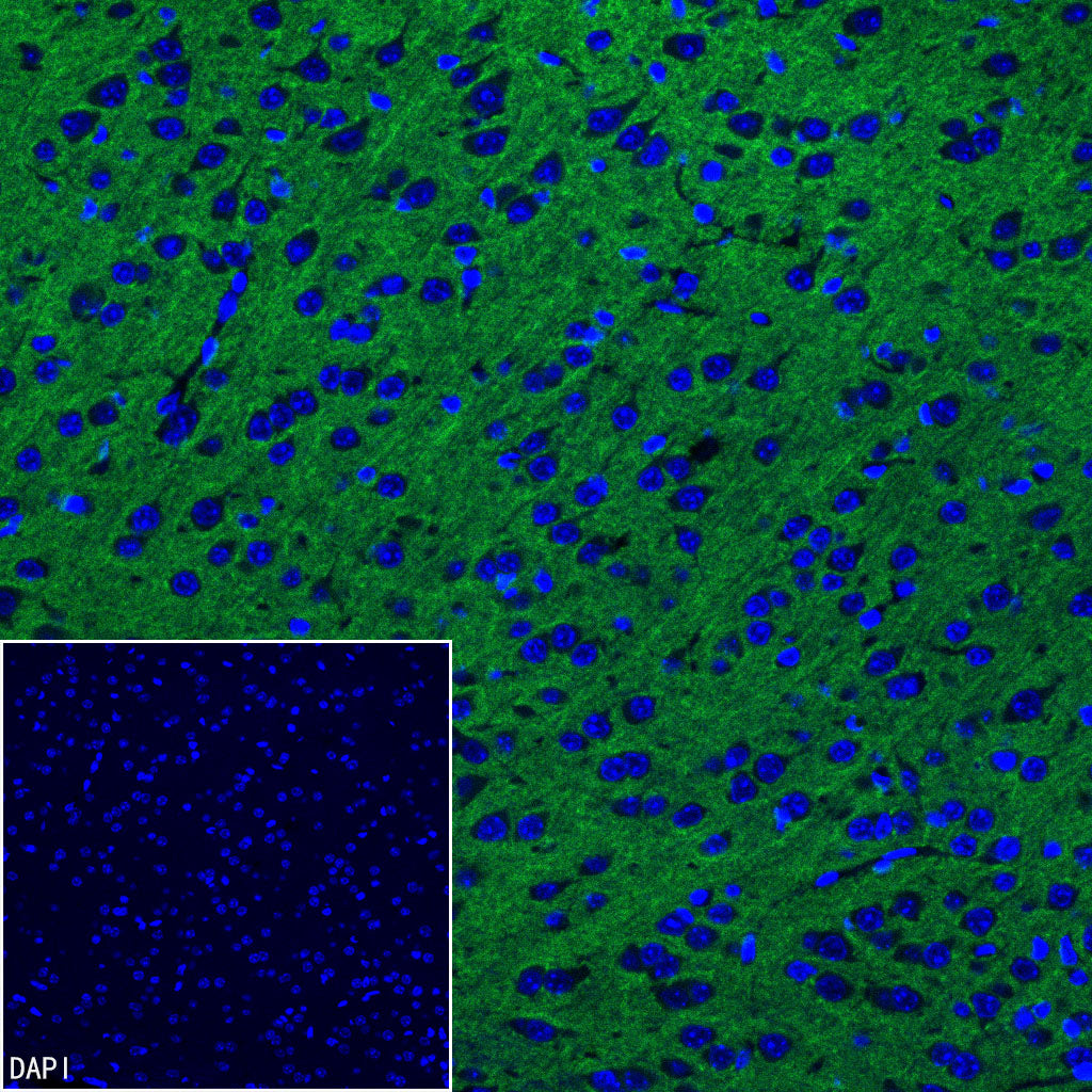 pan SCN Recombinant Rabbit mAb (S-5038)