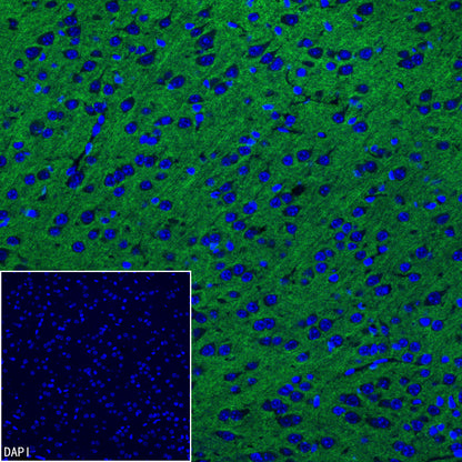 pan SCN Recombinant Rabbit mAb (S-5038)