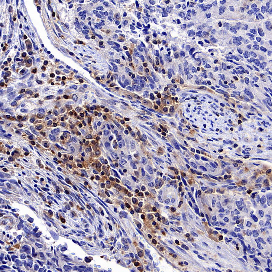 ARHGAP25 Recombinant Rabbit mAb (S-4005-5)