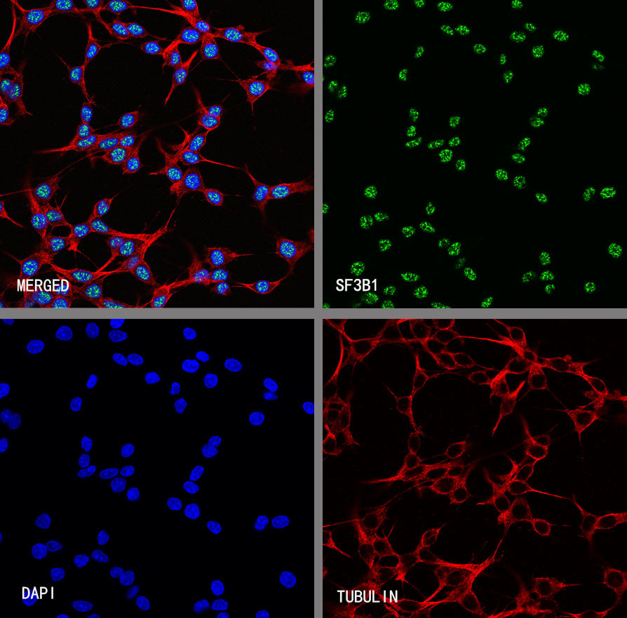 SF3B1 Rabbit Polyclonal Antibody