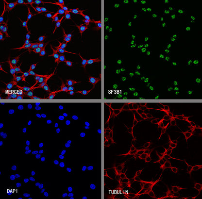 SF3B1 Rabbit Polyclonal Antibody