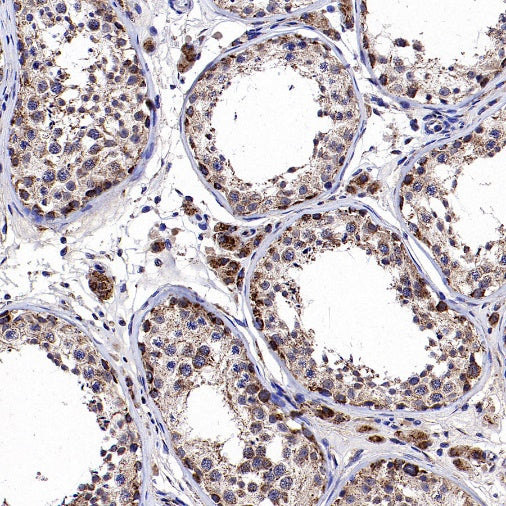 CHMP1a Recombinant Rabbit mAb (S-1651-159)