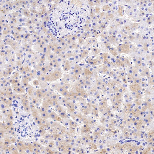 AAT Recombinant Rabbit mAb (S-943-37)