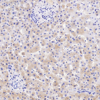 AAT Recombinant Rabbit mAb (S-943-37)