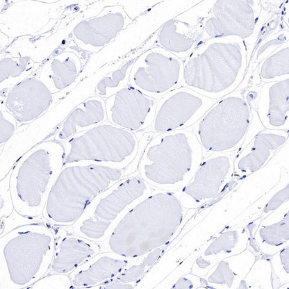 Neuropeptide Y Recombinant Rabbit mAb (S-1104-18)