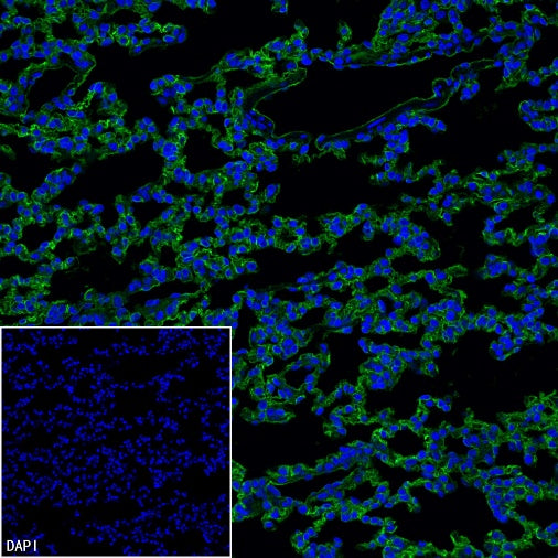 Angiotensin Converting Enzyme 1 Recombinant Rabbit mAb (SDT-2662-122)
