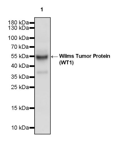 Wilms Tumor Protein (WT1) Recombinant Rabbit mAb (SDT-2864)