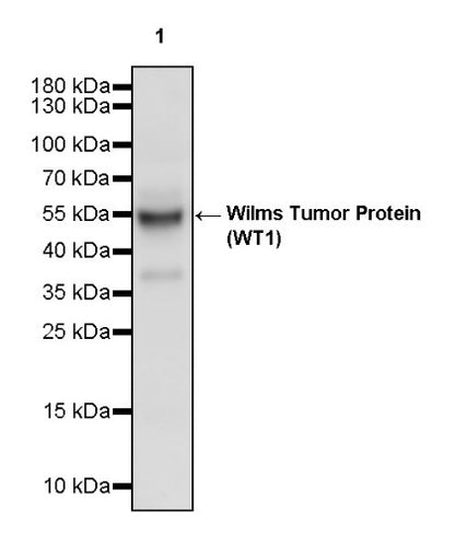Wilms Tumor Protein (WT1) Recombinant Rabbit mAb (SDT-2864)