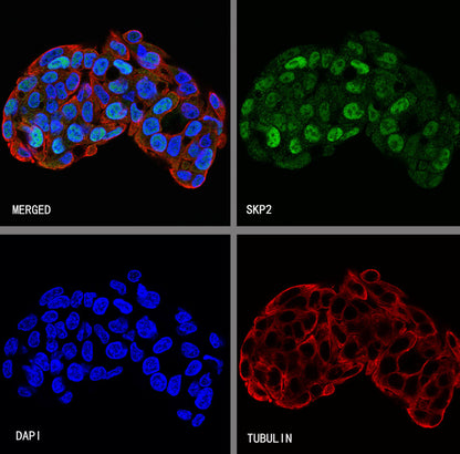 SKP2 Recombinant Rabbit mAb