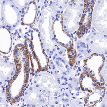 E-Cadherin Recombinant Rabbit mAb (SDT-438-45)