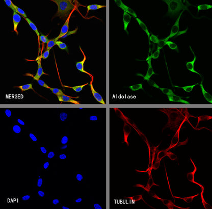 Aldolase A Recombinant Rabbit mAb (S-4007-23)