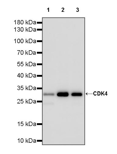 CDK4 Recombinant Rabbit mAb (S-685-210)