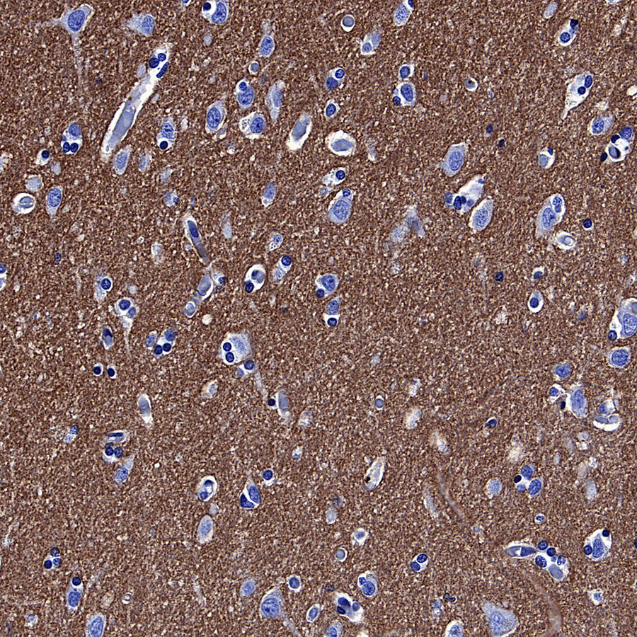 GLUT3 + GLUT14 Recombinant Rabbit mAb (S-5945)