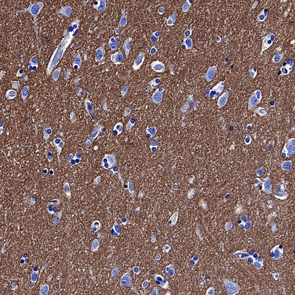 GLUT3 + GLUT14 Recombinant Rabbit mAb (S-5945)