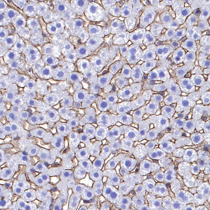 Integrin alpha 5 Recombinant Rabbit mAb (S-381-37)