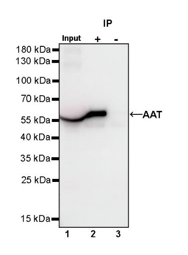 AAT Recombinant Rabbit mAb (S-943-37)