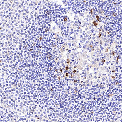 CXCL13 Recombinant Rabbit mAb (SDT-2703-132)