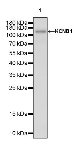 KCNB1 Recombinant Rabbit mAb (S-2527-21)