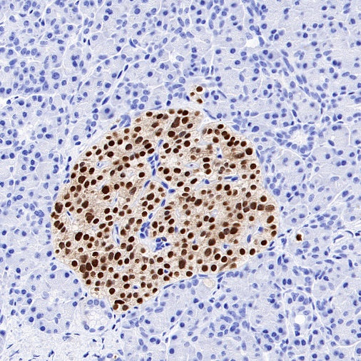 PAX6 Recombinant Rabbit mAb (SDT-1258-145)