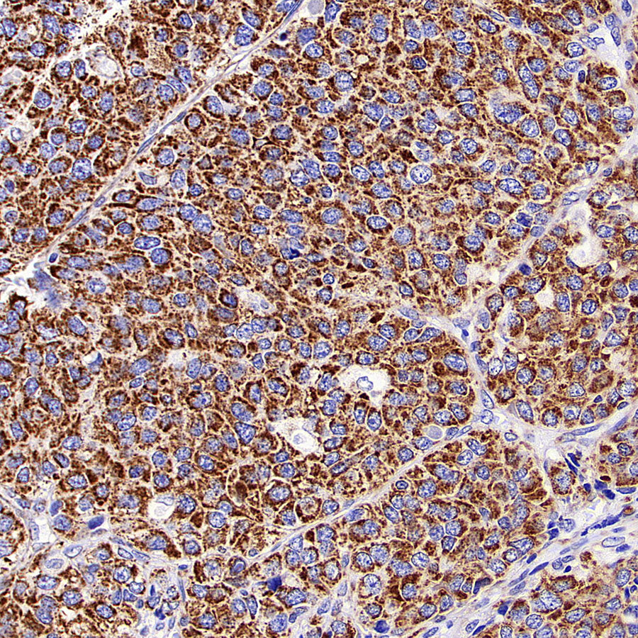 TOM20 Recombinant Rabbit mAb (S-M0015)
