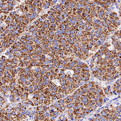 TOM20 Recombinant Rabbit mAb (S-M0015)