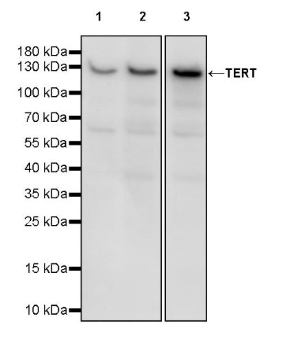 TERT Recombinant Rabbit mAb (S-1246-143)